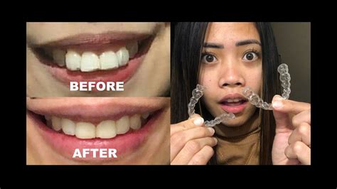 Braces Auburndale Reviews, Ratings .